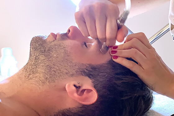 Un tratamiento facial con microdermoabrasión para 1 en Policlínica del Río-Hortega en Santa Pola (Alicante)