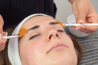 Una sesión de microneedling para 1 en Upsala Estética Avançada en Barcelona