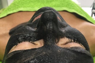 Un tratamiento facial con microdermoabrasión para 1 en Policlínica del Río-Hortega en Santa Pola (Alicante)