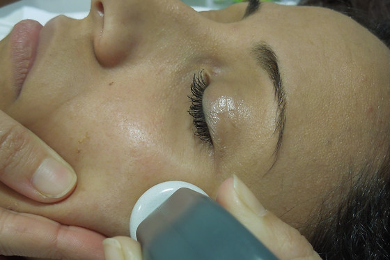 Un tratamiento facial con microdermoabrasión para 1 en Policlínica del Río-Hortega en Santa Pola (Alicante)